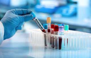 Testosterone Test Explained